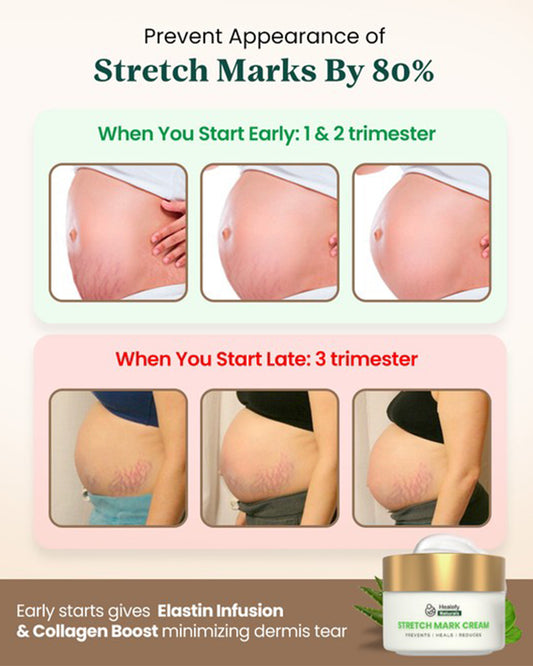 Healofy Naturals Stretch Marks Cream-Pregnancy & Breastfeeding Safe